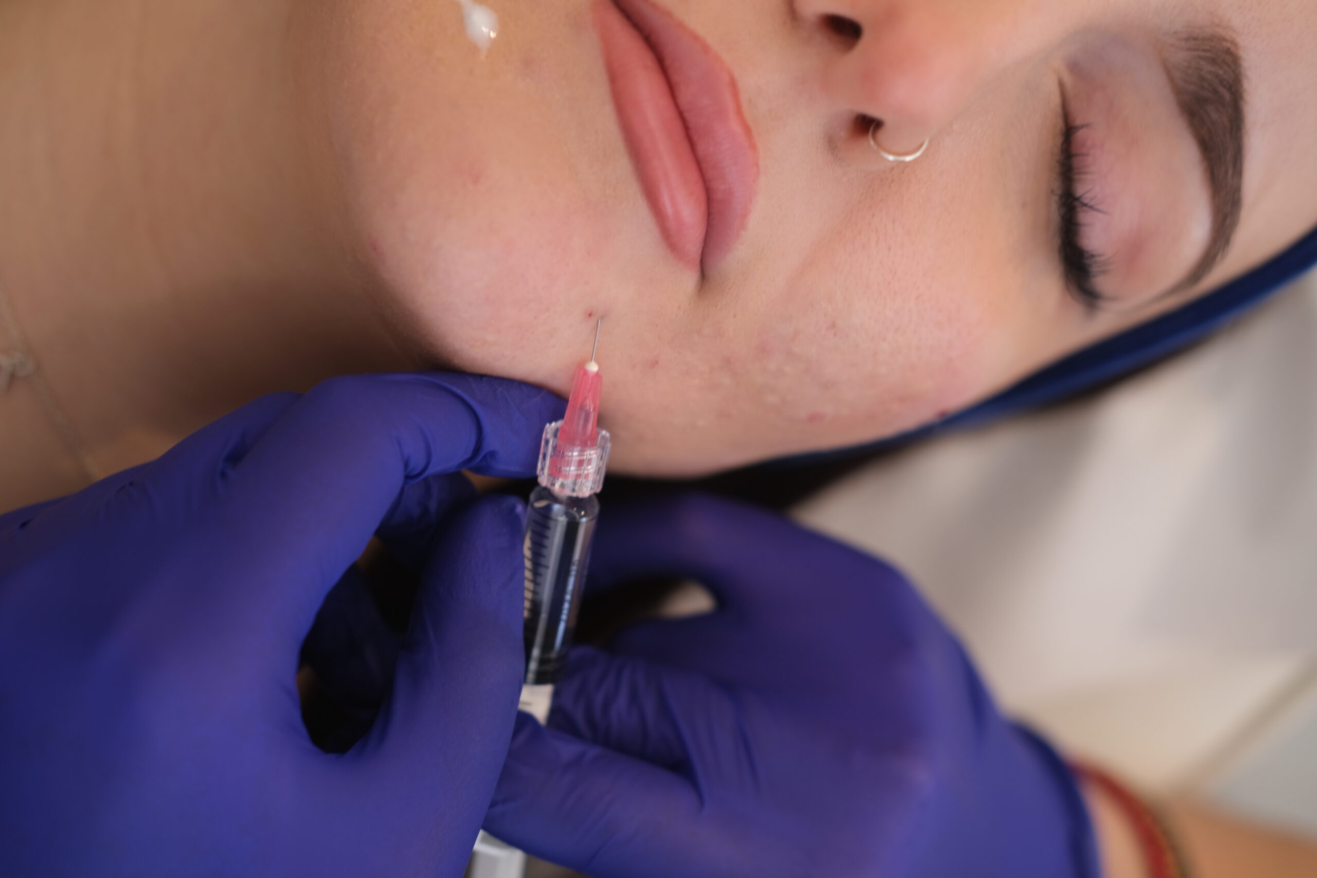 Aesthetic Injectables